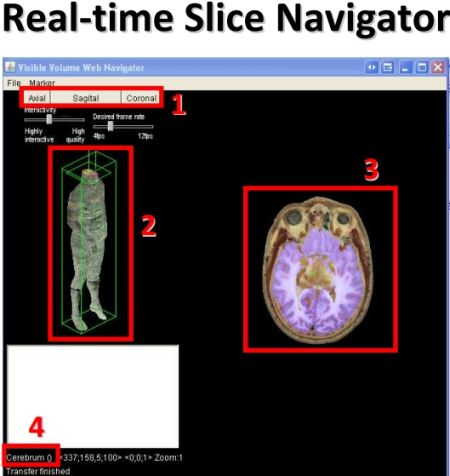 Anatomia Corpo Umano 3D con il Visible Human Server